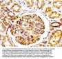 ACTA1 Recombinant Monoclonal Antibody
