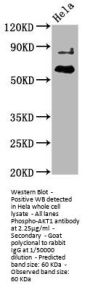 Phospho-AKT1 (T450) Recombinant Monoclonal Antibody