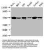 ATF4 Recombinant Monoclonal Antibody