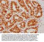 ATF4 Recombinant Monoclonal Antibody