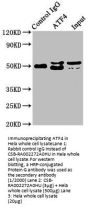 ATF4 Recombinant Monoclonal Antibody