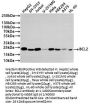 BCL2 Recombinant Monoclonal Antibody