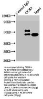 CCR9 Recombinant Monoclonal Antibody