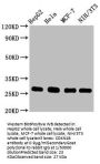 CDKN1B Recombinant Monoclonal Antibody