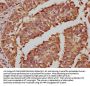 FOS Recombinant Monoclonal Antibody