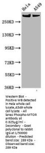 Phospho-MTOR (S2448) Recombinant Monoclonal Antibody