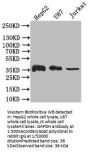 GAPDH Recombinant Monoclonal Antibody