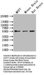 GFAP Recombinant Monoclonal Antibody