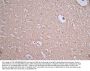 GFAP Recombinant Monoclonal Antibody