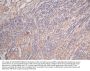 GFAP Recombinant Monoclonal Antibody
