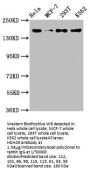 HDAC9 Recombinant Monoclonal Antibody