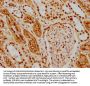 HDAC9 Recombinant Monoclonal Antibody