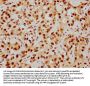 HDAC9 Recombinant Monoclonal Antibody