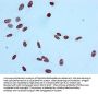Acetyl-Histone H2A type 1-B/E (K9) Recombinant Monoclonal Antibody