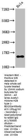 Acetyl-Histone H2B type 1-B(K20)Recombinant Monoclonal Antibody