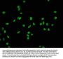 Acetyl-Histone H2B type 1-B(K20)Recombinant Monoclonal Antibody