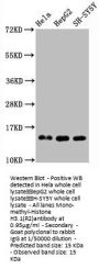 Mono-methyl-Histone H3.1(R2)Recombinant Monoclonal Antibody