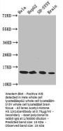 Acetyl-Histone H3.1(K14) Recombinant Monoclonal Antibody