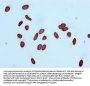 Acetyl-Histone H3.1(K14) Recombinant Monoclonal Antibody