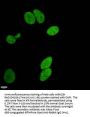 Mono-methyl-Histone H3.1(R17) Recombinant Monoclonal Antibody