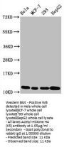 Acetyl-Histone H4 (K5) Recombinant Monoclonal Antibody