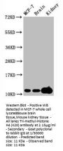 Tri-methyl-Histone H4 (K20) Recombinant Monoclonal Antibody