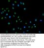HNRNPC Recombinant Monoclonal Antibody