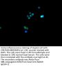 HNRNPC Recombinant Monoclonal Antibody