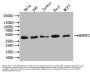 HNRNPC Recombinant Monoclonal Antibody