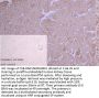 HNRNPC Recombinant Monoclonal Antibody