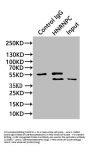 HNRNPC Recombinant Monoclonal Antibody