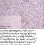 HNRNPC Recombinant Monoclonal Antibody