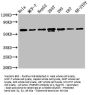 HNRNPK Recombinant Monoclonal Antibody