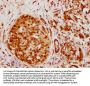 HNRNPK Recombinant Monoclonal Antibody