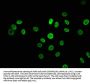 HNRNPK Recombinant Monoclonal Antibody
