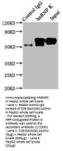HNRNPK Recombinant Monoclonal Antibody