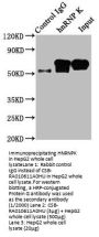 HNRNPK Recombinant Monoclonal Antibody