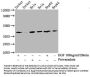 Phospho-LAT (Y191) Recombinant Monoclonal Antibody