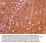 Phospho-LAT (Y191) Recombinant Monoclonal Antibody