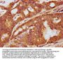 Phospho-LAT (Y191) Recombinant Monoclonal Antibody