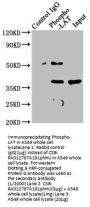 Phospho-LAT (Y191) Recombinant Monoclonal Antibody