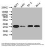 LGALS3 Recombinant Monoclonal Antibody