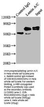 LMNA Recombinant Monoclonal Antibody