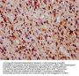 Phospho-MAPK3 (T202) + MAPK1 (T185) Recombinant Monoclonal Antibody