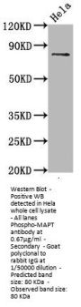 Phospho-MAPT (S396) Recombinant Monoclonal Antibody