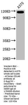 CD146 Recombinant Monoclonal Antibody