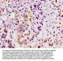 CD146 Recombinant Monoclonal Antibody