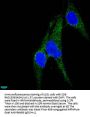 CD146 Recombinant Monoclonal Antibody