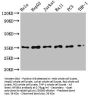 NFKBIA Recombinant Monoclonal Antibody
