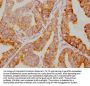 NFKBIA Recombinant Monoclonal Antibody